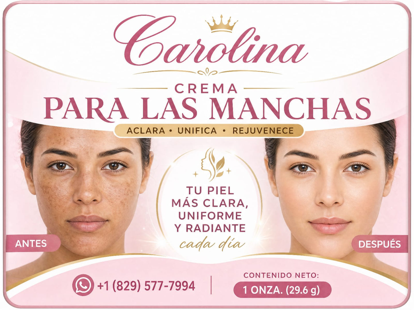 Crema para las manchas de alta calidad, melasma, sol, zonas oscuras, piel clara, carolina